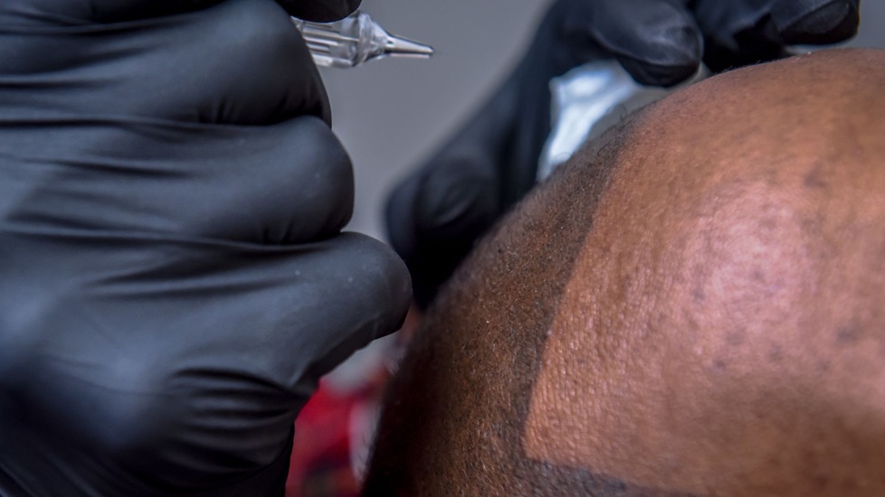 What Happens to Scalp Micropigmentation as You Age?